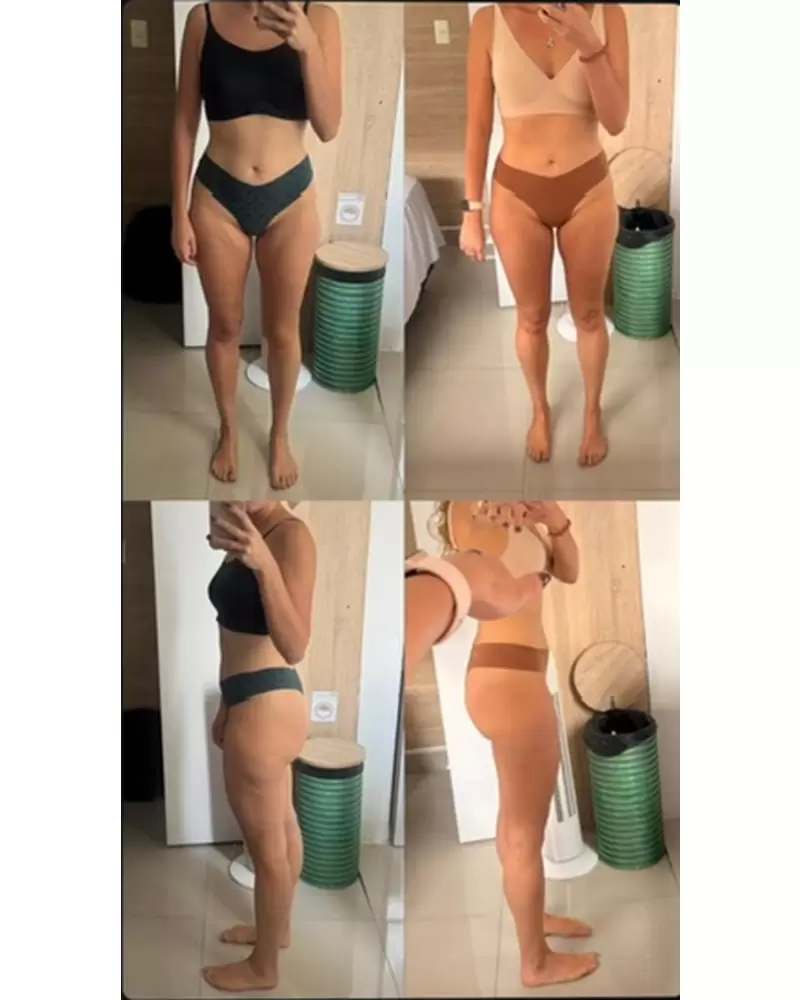 Antes y después de una participante, de frente y de perfil.